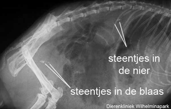 Op de rntgenfoto is te zien dat er stenen in de blaas en in de nier aanwezig zijn